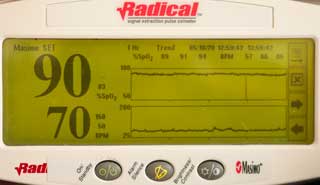 MASIMO 1269 SPO2 Adult Hard Shell Finger
                        Sensor LNOP F-Tab