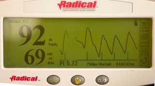 MASIMO 1269 SPO2 Adult Hard Shell Finger
                        Sensor LNOP F-Tab